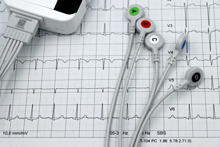 Close-up of an electrocardiogram (ECG) printout with several labeled ECG electrode leads (A–G) connected to a monitoring device, displaying clear heart rhythm waveforms across multiple channels.