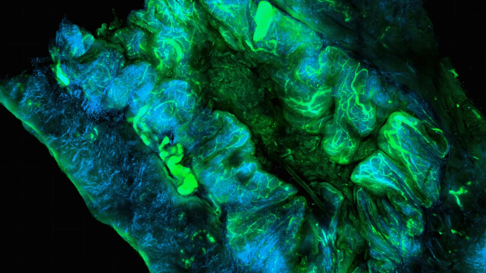  Tumor Microenvironment