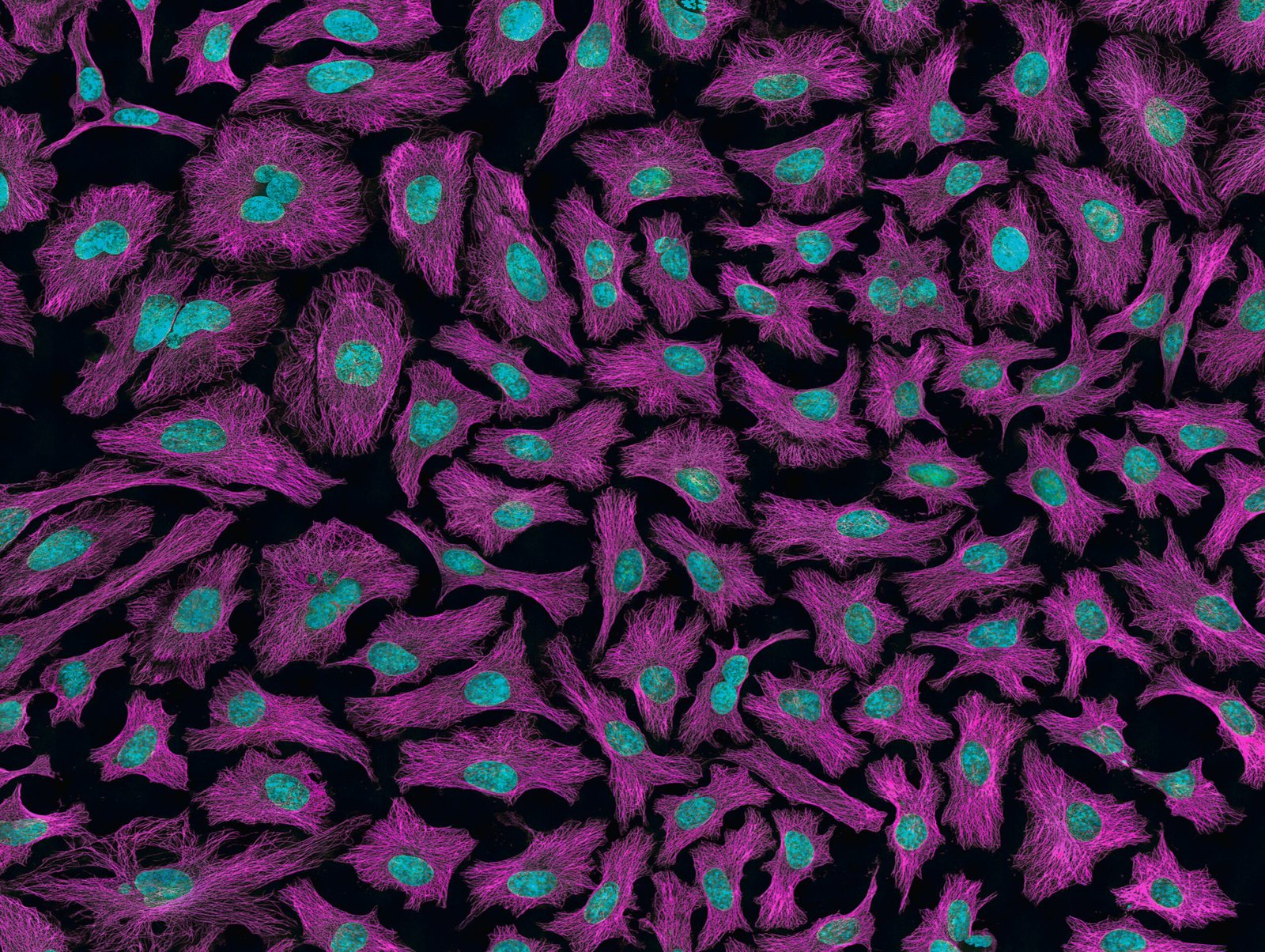 Cells from cervical cancer.