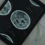 Featured image placeholder 16:9